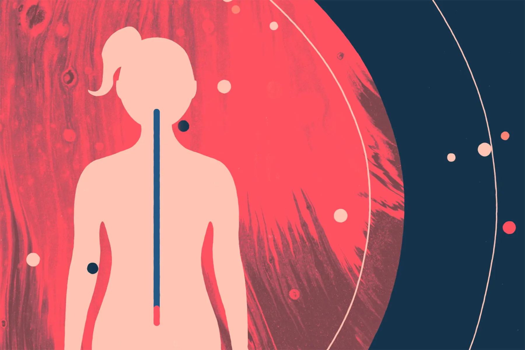What Is Type 1 Diabetes?