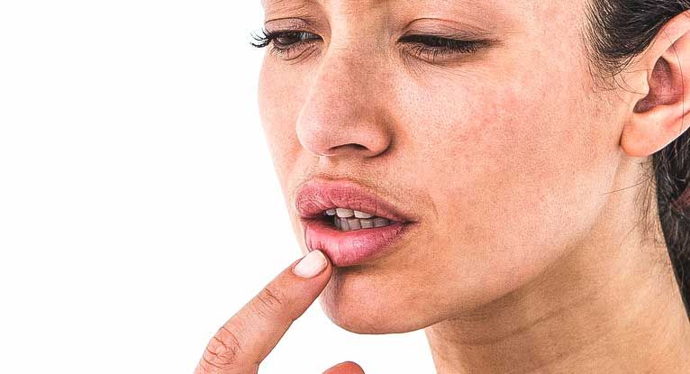 Stomatitis: Definition and Patient Education