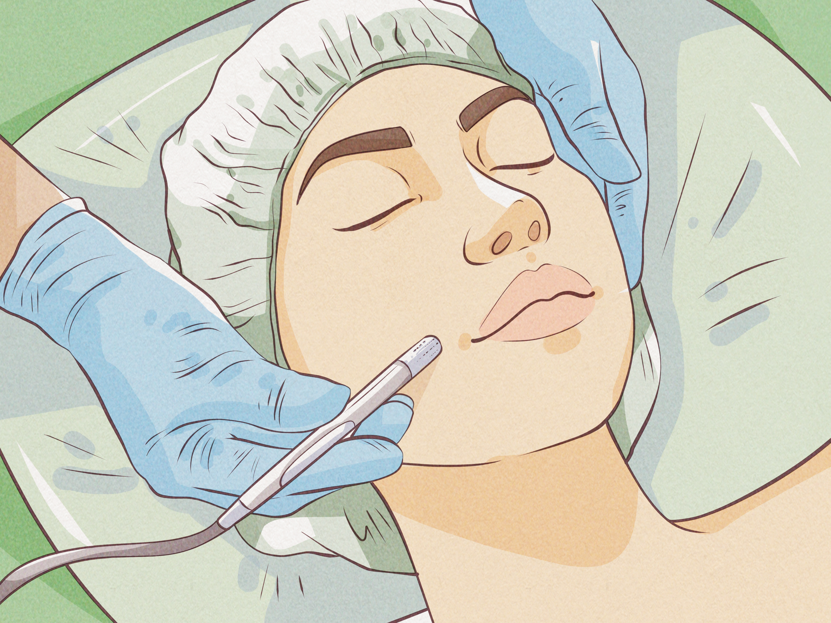 4 Ways to Apply Toothpaste on Pimples