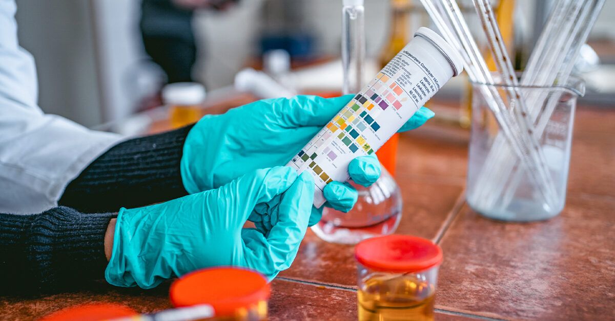 Urine pH Level Test: Purpose, Procedure, Results & More