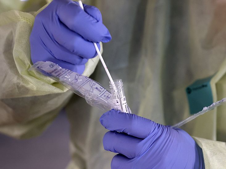 Coronavirus (COVID-19) Tests: Methods, Availability, and Accuracy