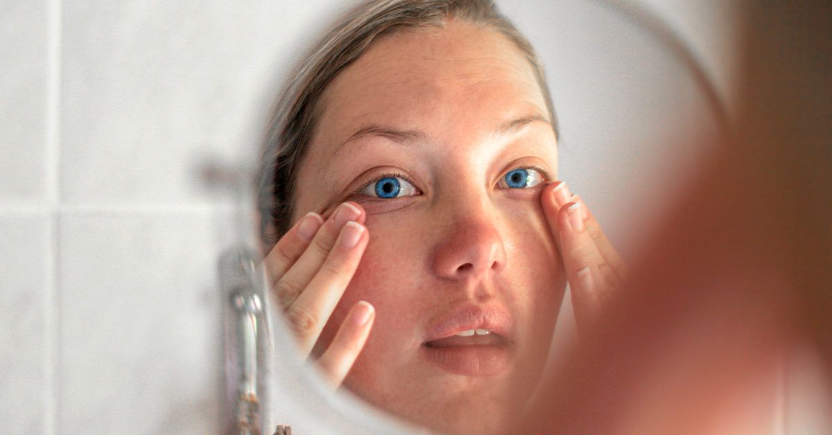 Bulging Eyes: Causes, Diagnosis, and Treatments